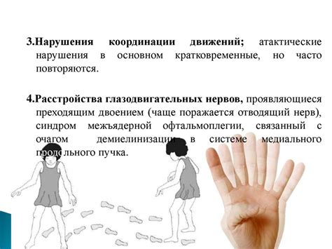 Этиологию и патогенез рассеянного склероза - презентация онлайн