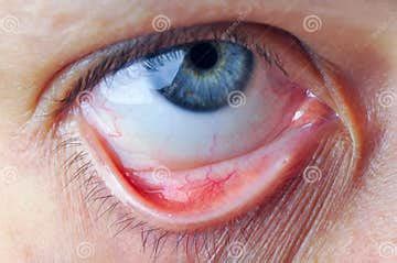Eye and conjunctival sac stock image. Image of conjunctiva - 159927407