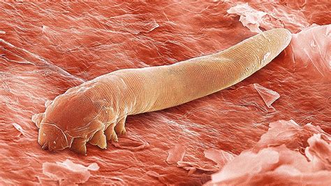 Статьи - demodex.by