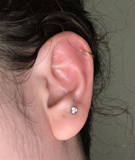 Early signs of infected helix? : r/piercing