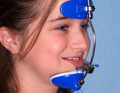 headgear braces  types  orthodontic headgear
