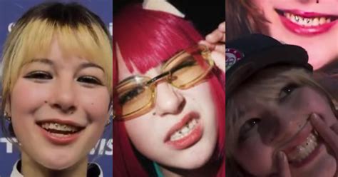 What's Up with Alysa Liu's Teeth?