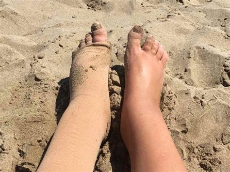 Purpose of waring compression sleeves in Lymphedema - health faith strength