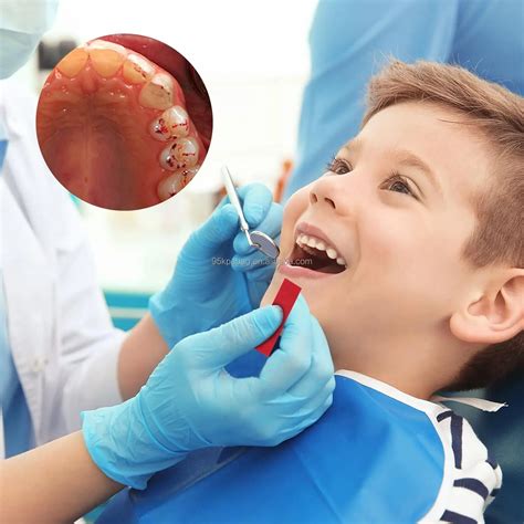 Dental Occlusion Paper - Accurate Bite Articulating Strips