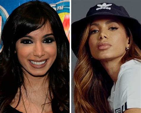 Anitta brinca com filtro e fala de plástica: "Cada dia ia estar com uma