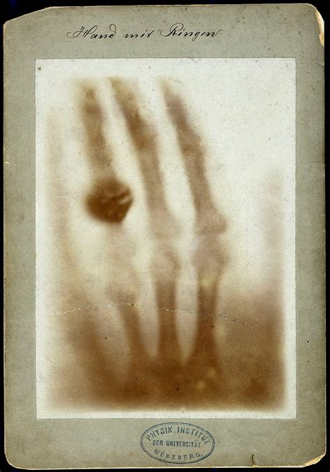 Wilhelm Conrad Roentgen