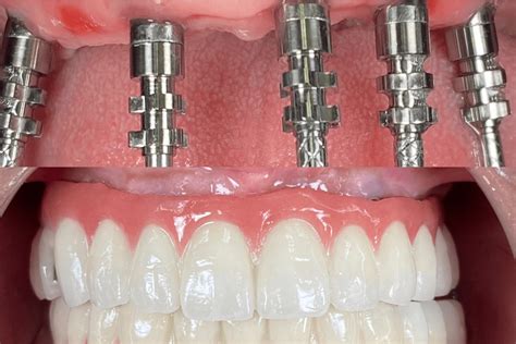 Bali Dentist | Affordable Dental Care at Kalm Dental Care