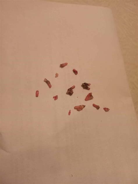 Хозяйка умерла. Кошку в переноску и на помойку. 26 октября операция по ...