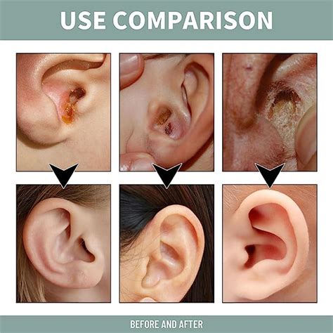 how to relieve pressure in ears 9