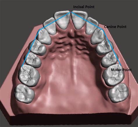 considered  dental arch  lynne griffin blog
