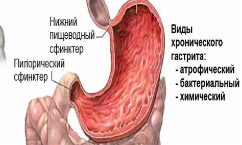 Що представляють собою симптоми дуоденіту