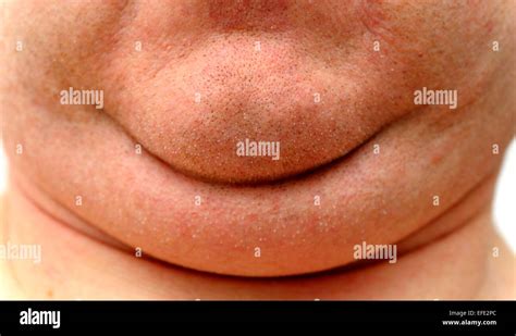 Chin