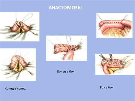 Абдоминальная хирургия - презентация онлайн