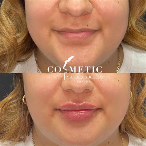 Hottest Women Celebrity's Shocking Transformation: Before & After! Image 3