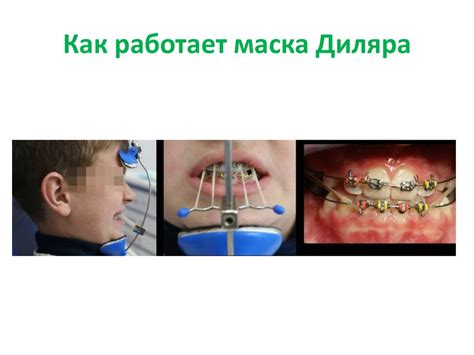 Аппаратурный метод лечения в стоматологии - online presentation