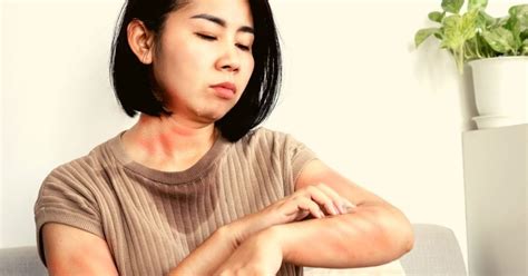 Tea Therapy: A Natural Approach to Treating Cutaneous Myiasis - It's ...
