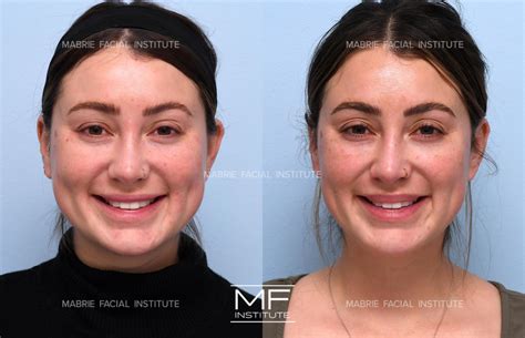 Trying Fringe for Round Face offers a surprising slimming effect 3