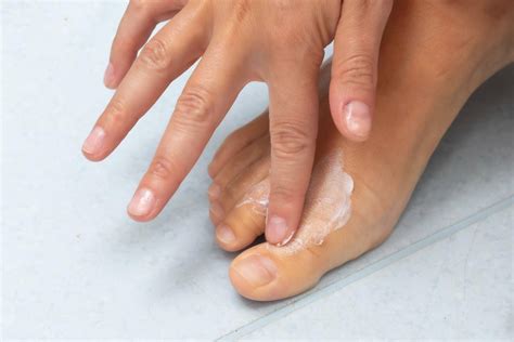 how much sunlight to kill toenail fungus