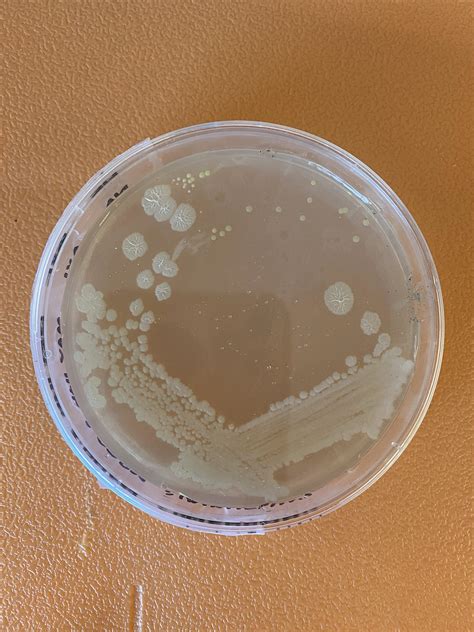 micrococcus luteus rmicrobiology