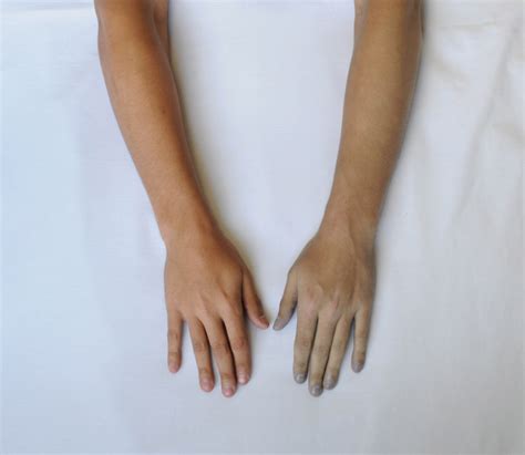 rigor mortis carlos salazar lermont