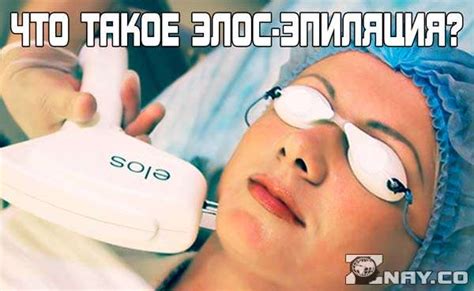 Элос-эпиляция: что это за процедура? Преимущества и недостатки, отличия ...