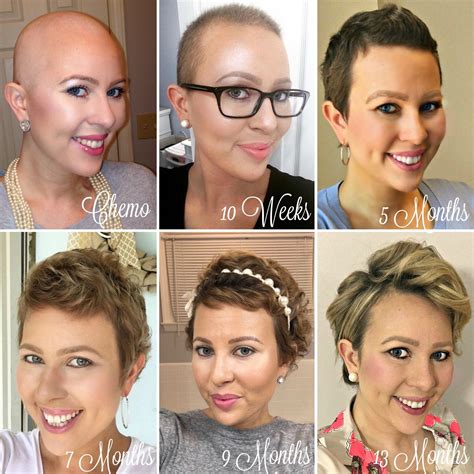 18 Tips How To Grow Hair Faster After Chemo - 22 Useful FAQs - Life Simile