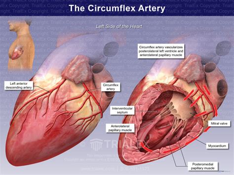 The Circumflex Artery - TrialQuest Inc.