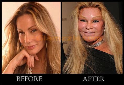 Pin on Plastic surgery /Makeup