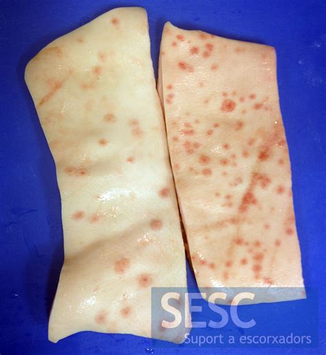 Fragments of skin with multiple rounded, reddish lesions and with a
