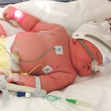 Is This The Biggest Baby Bump Ever? Mum-To-Be Had Massive 55-inch Tummy ...