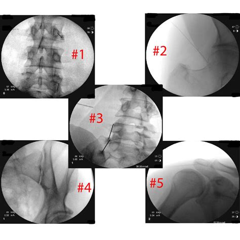 Interventional Spine Quiz - Elite Pain & Health - Oklahoma Pain