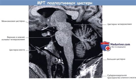 Топография и характеристика оболочек головного мозга