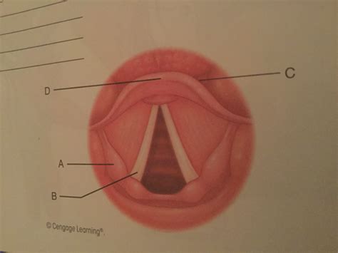 Picture 6 CMD 310 Diagram | Quizlet