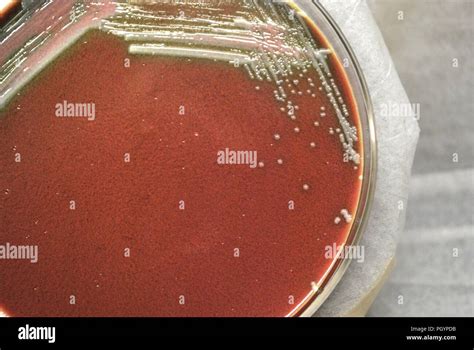 Bacteria francisella tularensis hi-res stock photography and images - Alamy