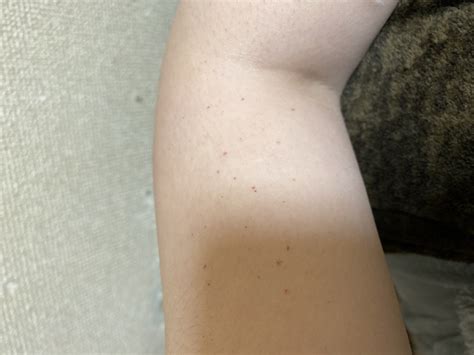 腕に小さい赤い斑点があります - 痒くはないですこれはなんでしょうか、... - Yahoo!知恵袋