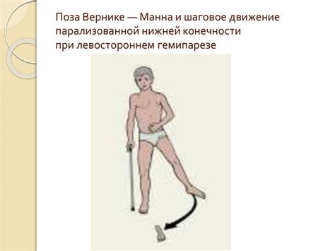 Двигательная сфера. Методы исследования - online presentation