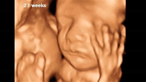 27 Weeks Pregnant - 3D Ultrasound Gallery - YouTube