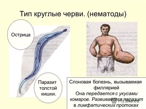 Презентация на тему: "Тип круглые черви. (нематоды) Мононх-однозуб ...
