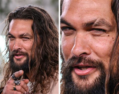 Jason Momoa Scars