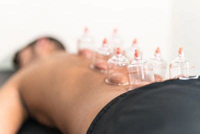 cupping therapy  pleasant grove ut dr knapton