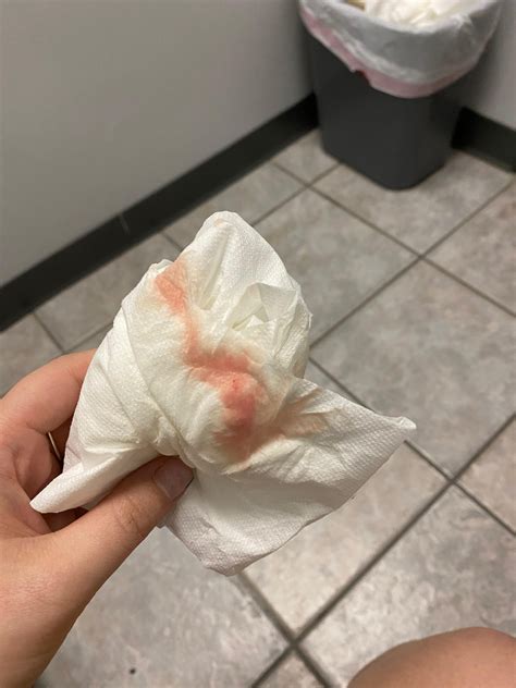 Heavy Period Blood In Toilet Dark Brown Period Blood: Why Is My Period