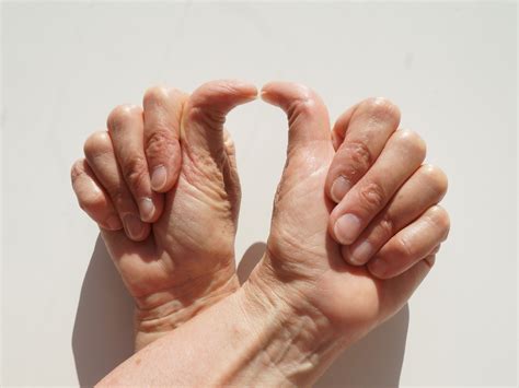 Double Jointed People | Double Jointed Meaning – OVNI