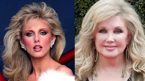 morgan fairchilds plastic surgery  helping   young