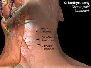 Cricoid Cartilage - Definition, Location, Function, Problems - (updated ...