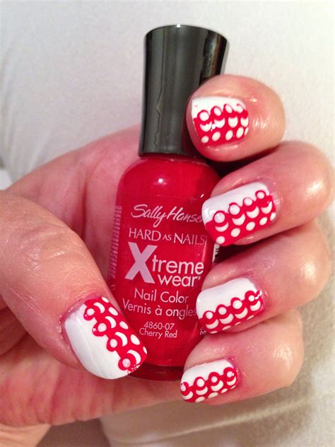 What Do White Patches On My Nails Mean - Design Talk