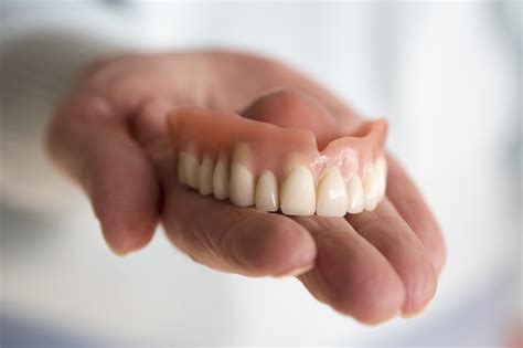 frequently asked questions  upper dentures   bounds