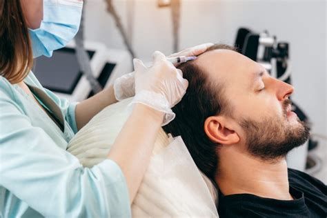 PRP Hair Treatment Before and After: What to Expect - hairhelpline.com