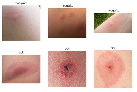 Effect of Insect Bites And Stings of Our Body | 24x7 Pest Control