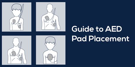 Guide to AED Pad Placement - MDPRO USA