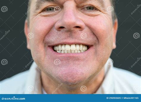 Homem Com Dente Grande - Muito Perto De Um Sorriso De Homem Com Dentes Grandes Imagem de Stock ...